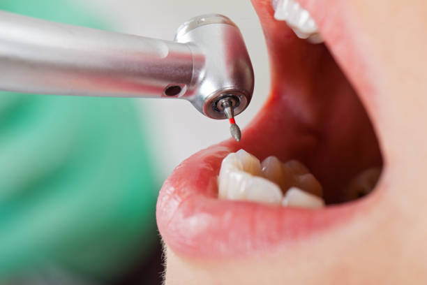 Best Walk-In Emergency Dentist in Pimlico, SC